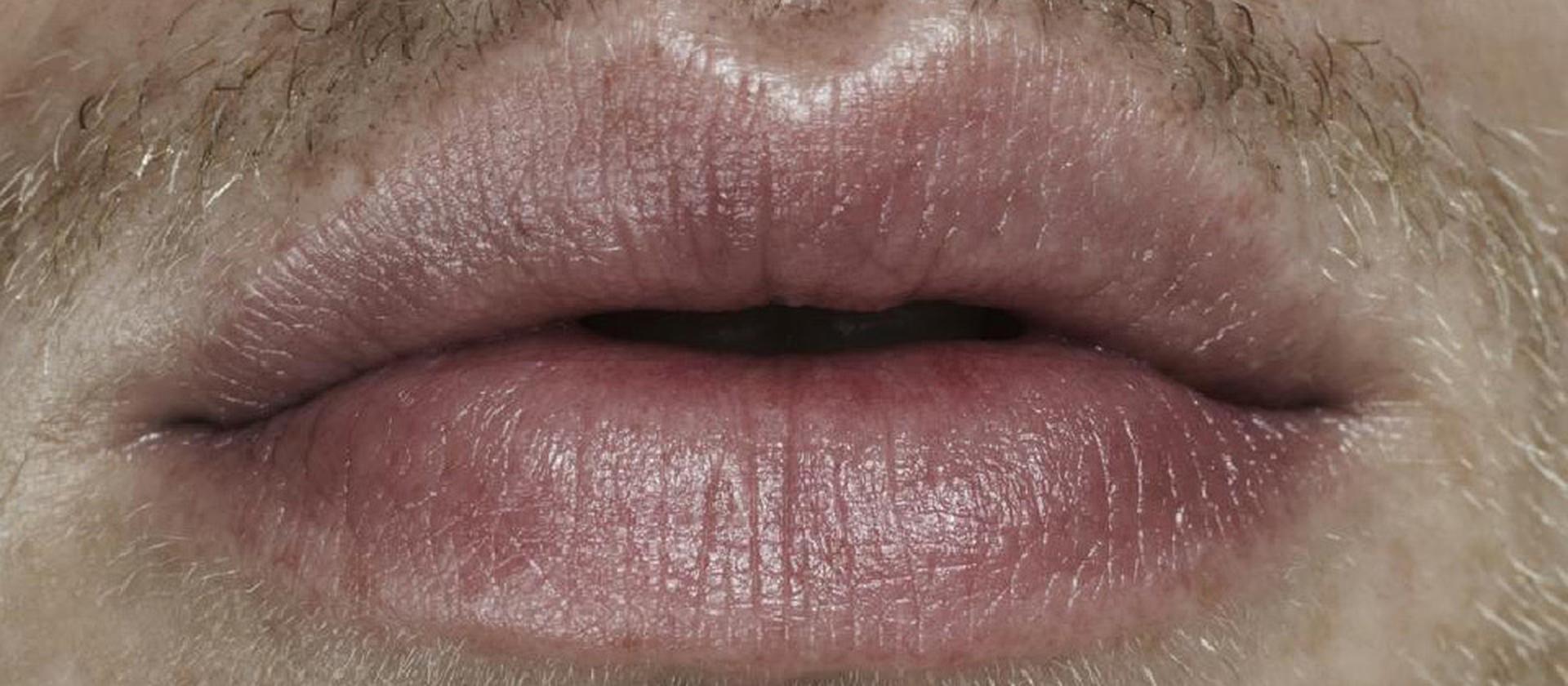 Cánones estéticos de los labios