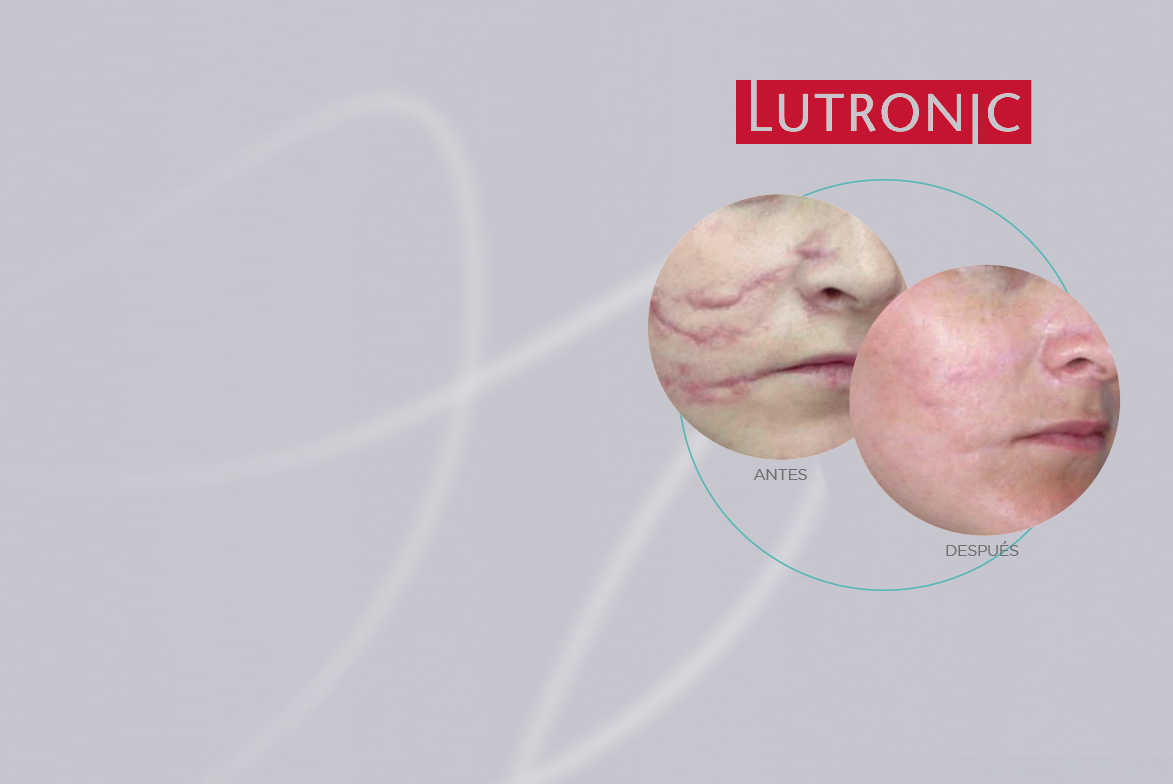 Lutronic